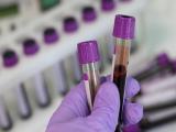 Análisis de sangre puede identificar cáncer y metástasis